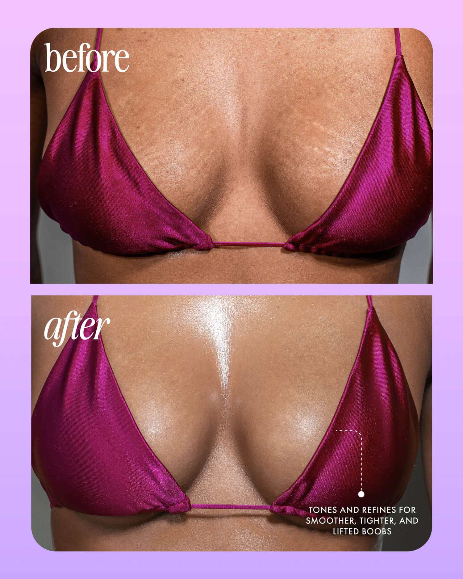 Acai Your Boobies Firming Body Serum - Image 5